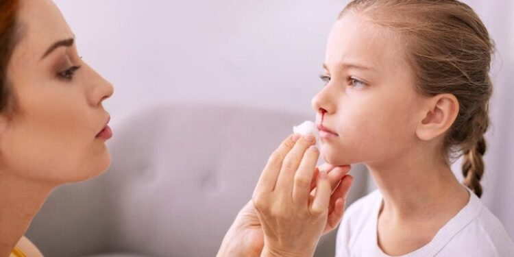 chảy máu cam ở trẻ